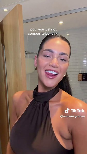 New smile day @re_ignite.dental 😄✨ #fyp #compositebonding | composite