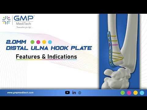 GMP MediTech - 2 0 mm Ulna Hook Plate Features & Indications