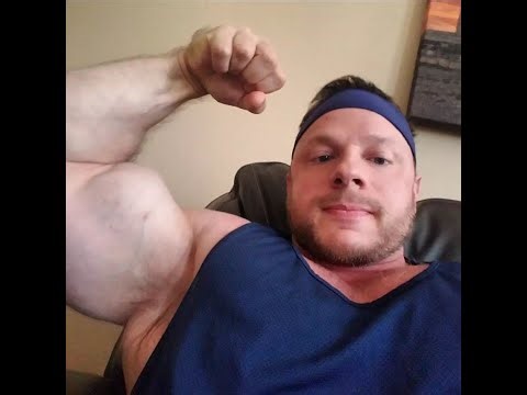 Distal Bicep Tendonitis - Rehab Protocol