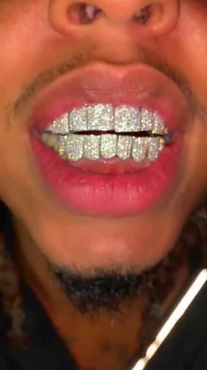 Real Diamond Braces DIY for Hip-Hop Jewelry Enthusiasts