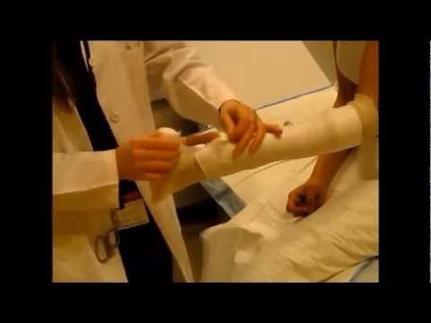 How to Apply a Short arm Cast