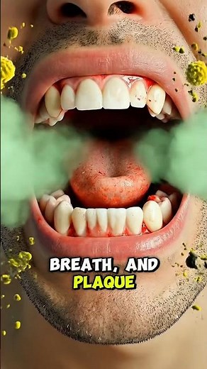 Sleeping With Mouth Open? What Really Happens