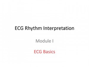 ECG Rhythm Interpretation - SlideServe
