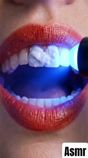 teet cleaning asmr #asmr #satisfying #teeth