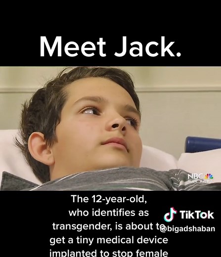 Jack, 12, identifies as transgender and had a tiny medical device implanted in his arm to pause the effects of female puberty. With 30 states taking action to block gender-affirming care for minors, I wanted to revisit some of the reporting I’ve done on the issue over the years. Here’s a clip from our documentary “Transgender Kids: A Changing Student Body” . . . . . . . #transgenderchildren #transgender #transgenderkids #transgenderdebate #transdebate #transgenderrights #puberty #pubertyblockers