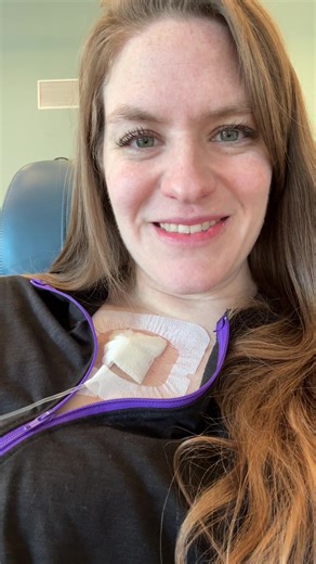 Benlysta day 💜 #lupus #lupuswarrior #autoimmunedisease #lupuswarrior🦋💜 #sle