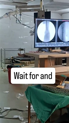 Suprapatellar Tibial Nailing: Future or Fad and removal....