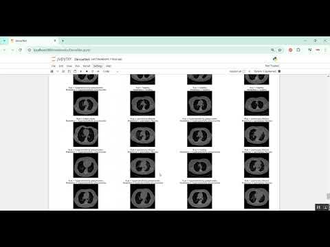Lung Diseases Predication using DenseNet in Python Projects