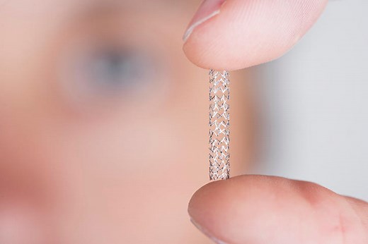 Stent cardiaco ed angioplastica coronarica, quello che devi sapere