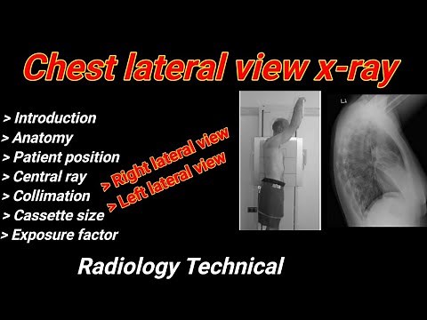 Chest Lateral view X-ray # Right & Left lateral projection # Chest radiography # By BL Kumawat #