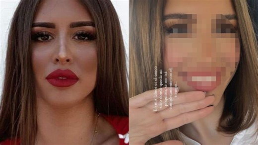 Marina García se quita las prótesis y vuelve a lucir su pecho al natural: el resultado