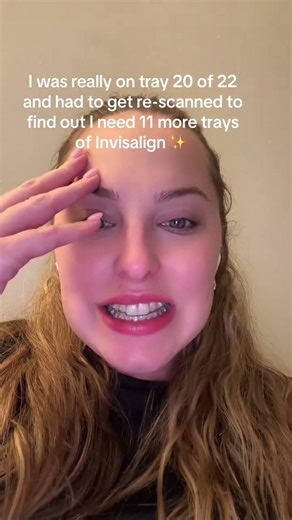 Why Invisalign needs to be rescanned?