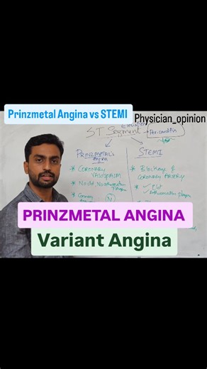 MD Medicine Physician 🏥 | ECG Challenge: Prinzmetal Angina vs STEMI! Prinzmetal (Variant) Angina: - Transient ST-elevation due to _coronary artery spasm_. - Chest... | Instagram