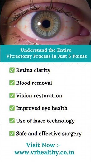 Vitrectomy Explained in 6 Key Points | Clear Vision Starts Here