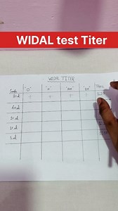 WIDAL test Titer||#labtechnician #bscnursing #trendingreels #pathology #paramedical #dmlt #dmltcourse #educationreels | Rayyan Alam