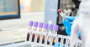 Co oznacza obniżone PCT w morfologii?