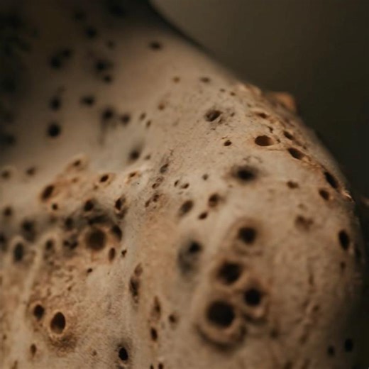 Trypophobia skin disease UP CLOSE#creepy #horrorshorts #phobia #trypophobia IVE EVER SEEN!