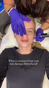 What HydraFacial Removes 👀💧
