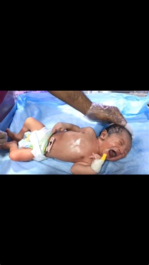 1K views · 24 reactions | Newborn Baby First Management & Cleaning ...