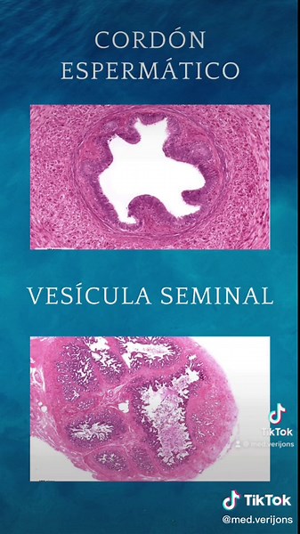 Histologia del aparato reproductor masculino #uvm #linces #semestrososmedicina