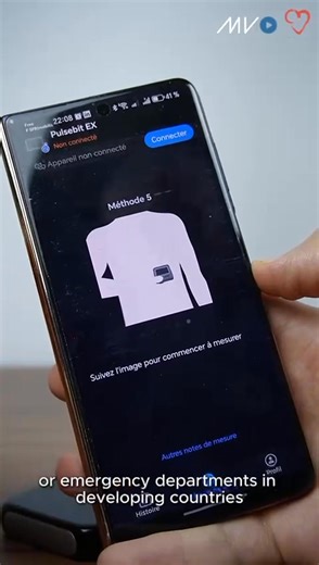 ⚡️ Portable ECG in Action Dr. Mekkaoui Abderrahmane, CardioVisual Ambassador, demonstrates the Pulsebit EX by Viatom, a compact, multi-lead ECG device with a built-in display and smartphone connectivity. Its versatility and ease of use make it especially valuable for mass screening and rapid detection in both clinical and resource-limited settings. Not sponsored by Viatom. This demonstration is for educational purposes only. Follow us for more cardiology innovations and insights. #Cardiology #EC