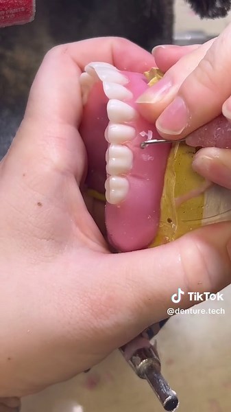 We need a lab tech in BOSIE ID link in bio to apply #smooth #dental #fyp