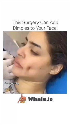Science on Instagram: "Dimpleplasty is a cosmetic surgery designed to create dimples on the cheeks — a feature often considered attractive and charming. The surgeon makes a small incision inside the mouth and attaches a tiny suture to form a natural-looking dimple when you smile. It’s a quick, safe, and minimally invasive procedure that enhances facial expression permanently. . . . #HumanDecode #Dimpleplasty #CosmeticSurgery #FacialAesthetics #BeautyScience #PlasticSurgery #DimpleSurgery #HumanB