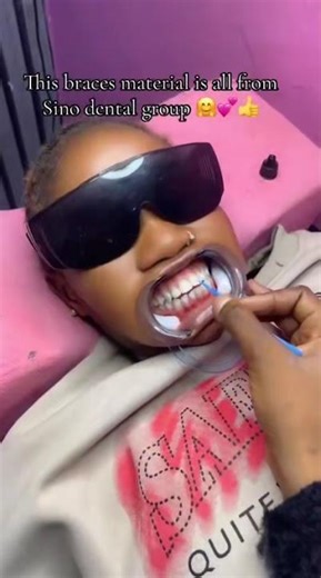 DIY Braces: A FULL List of Materials & Why You SHOULDN'T Use Them Yourself