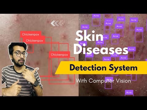 YOLO11 Skin Disease Detection | Train Custom Model with Computer Vision