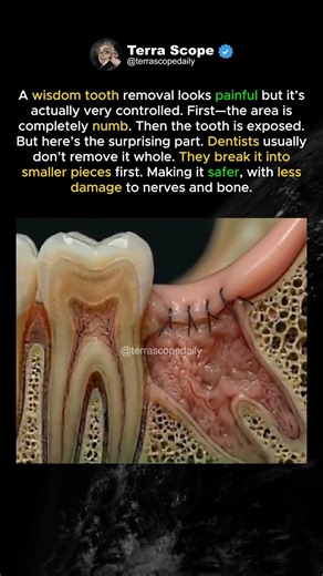 What Dentists Actually Do...