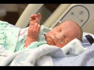 Trisomia 13(sindrom patau)