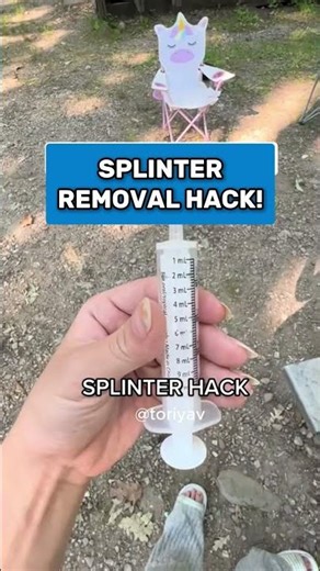 Splinter Removal Hack!