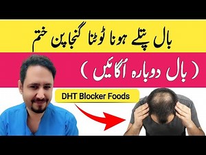 Top 5 Foods That Block DHT and Fight Hair Loss In Urdu Hindi - Irfan Azeem