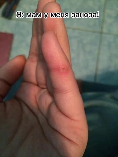 mirkuri_el1 on TikTok