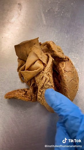 Exploring the Structure of a Real Human Heart