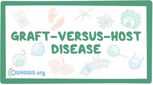 Graft-versus-host disease: Video, Causes, & Meaning | Osmosis