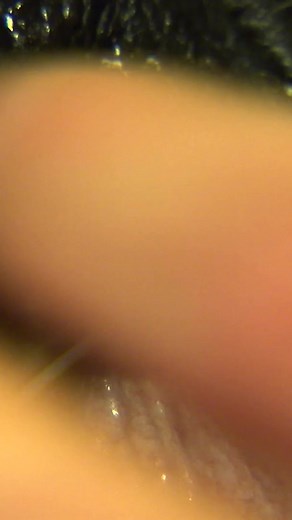 6.9M views · 10K reactions | This Tigers infected tooth is not pretty... 濫 | Untamed | Facebook