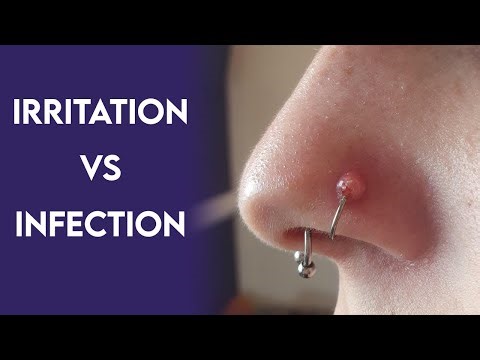 Body Piercer Explains: Irritation and Piercing Bumps