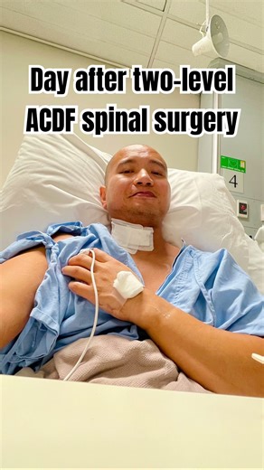 Day after two-level ACDF spinal surgery