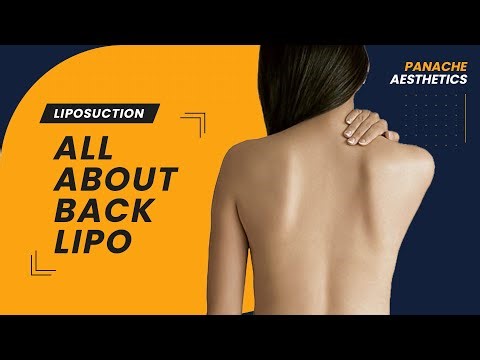 Back and sides Liposuction in females - 5 Before & After | Everything explained with real patients