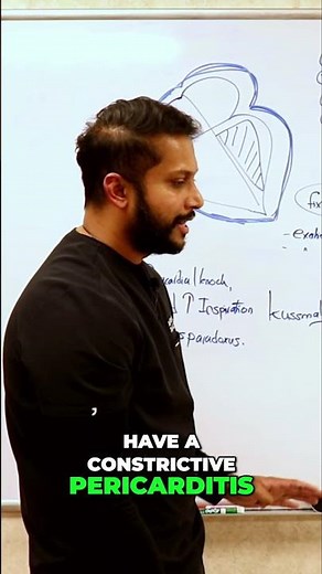 Constrictive Pericarditis Explained: Blood Flow Dynamics #shorts