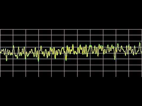 Cysts - Rife Frequencies