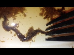 Foot-long Rope Worm Parasite Removal w/ Coffee Enema & Urine Therapy! [dirty] *WARNING GROSS*