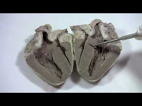 Dissection video of sheep heart - frontal section