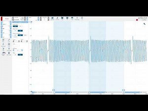 PicoScope 7 Automotive Phase Rulers