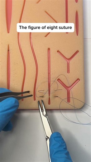 How surgeons stop bleeding ✨ #medicine #surgeon #suture #satisfying #anatomy #tips