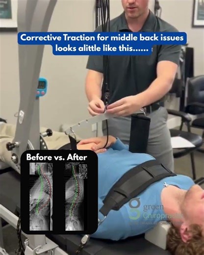 Corrective Traction for hunchback pisture looks alittle like this.......Omaha, Ne