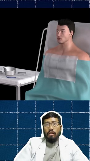 Ini caranya bilas lambung, prosedur naso gastrik tube, selang lambung untuk bilas dan memasukan makanan #bilaslambung #stroke #nasogastrictube