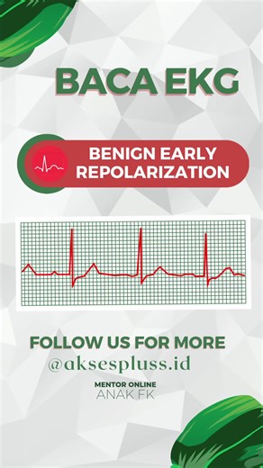Baca EKG lagi yuk🩺️🤗 Kali ini kita bahas mengenai Benign Early Repolarization✍🏻 Buat yg mau diskusi interaktif bisa follow instagram @aksespluss.id🤗👌🏻 #ilmukedokteran #aksespluss #bacaekg #edukasikesehatan #medstudent #ekg #kedokteran