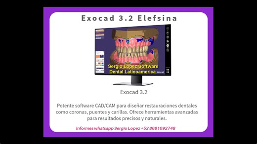 Exocad 3.2 full crack y venta de software dental MEXICO 2024